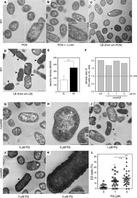 Exposure to stressors and antimicrobials induces cell-autonomous ultrastructural heterogeneity of an intracellular bacterial pathogen